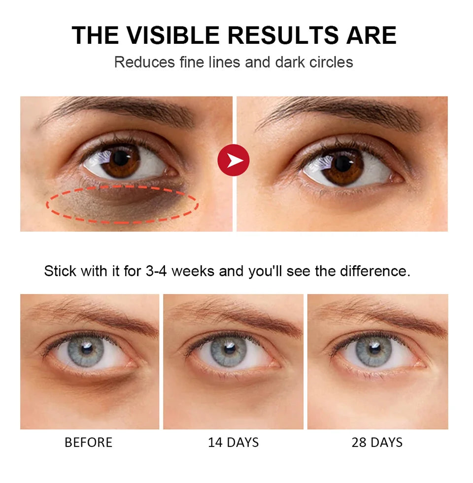 Retinol Eye Cream