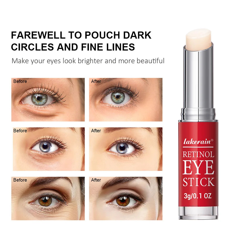 Retinol Eye Cream